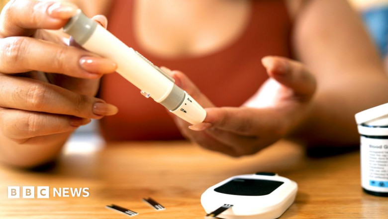 More women in their 20s are getting type 2 diabetes, experts warn