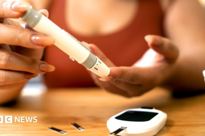 More women in their 20s are getting type 2 diabetes, experts warn
